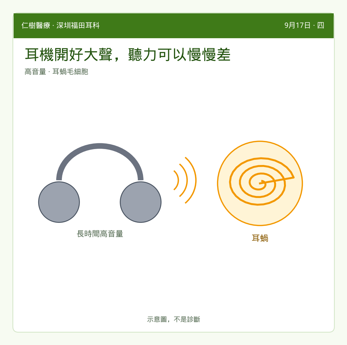 示意：高音量耳機與耳蝸